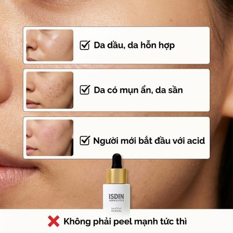 Serum ISDIN Isdinceutics Salicylic Renewal 30ml - Giảm mụn, Làm sáng da, Mờ thâm, Chăm sóc da dầu và hỗn hợp