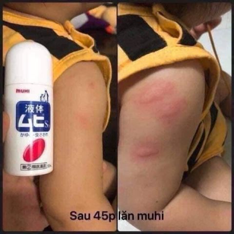[ Date 2027] Hàng Nhật - Lăn mỗi đốt Muhi 50ml 507116
