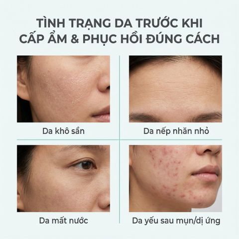 Tinh Chất Cấp Ẩm Phục Hồi Da La Roche-Posay Hyalu B5 Serum 30ml - Giúp Da Căng Mịn & Hỗ Trợ Làm Dịu Da Nhạy Cảm
