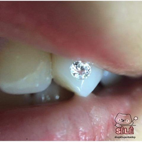 Bộ Đá Đính Răng 40 Viên - Combo Nhíp và Keo Dán Dễ Dùng Tại Nhà, Tăng Sức Hấp Dẫn Cho Nụ Cười, Độ Sáng Bảo Hành 6 Tháng