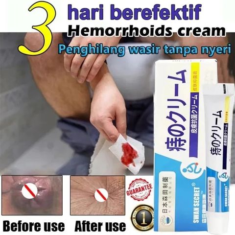 Kem Bôi Trĩ Nhật Bản Kháng Khuẩn - Giảm Đau Rát, Ngứa, Hỗ Trợ Co Và Teo Bũi Trĩ 20g - Sản Phẩm Chăm Sóc Cá Nhân Hiệu Quả