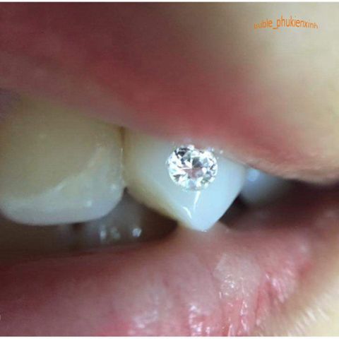 Combo Đá Đính Răng 40 Viên Kèm Keo & Nhíp Gắn - Phụ Kiện Thời Trang Độc Đáo Dễ Dàng Sử Dụng Tại Nhà, Bảo Hành 6 Tháng