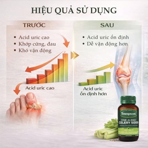 Viên Uống Thompson's Celery 5000mg - Hỗ Trợ Giảm Acid Uric và Sức Khỏe Xương Khớp - Thực Phẩm Bổ Sung New Zealand 60 Viên