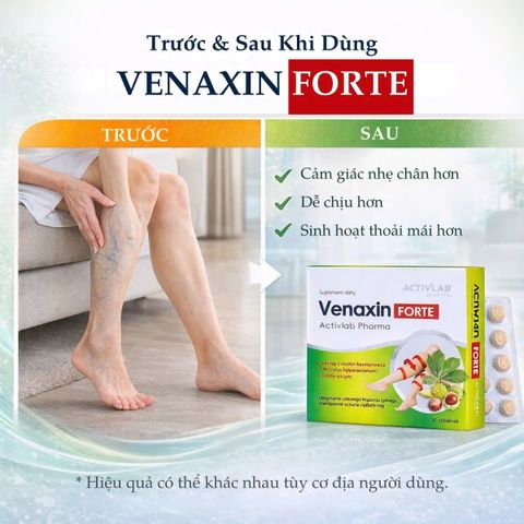 Viên uống hỗ trợ tĩnh mạch Venaxin FORTE giảm nặng chân 30 viên