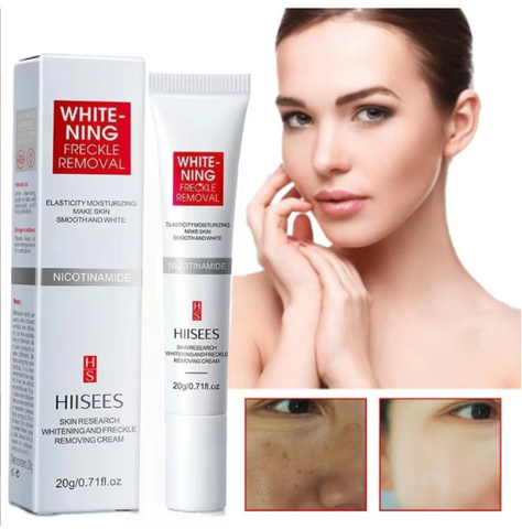 Kem Bôi Nám Ngày Đêm YOUBUY HIISEES - Dưỡng Ẩm, Làm Trắng Da, Mờ Thâm Nám, Chống Tàn Nhang - Sản Phẩm Chăm Sóc Da Tối Ưu