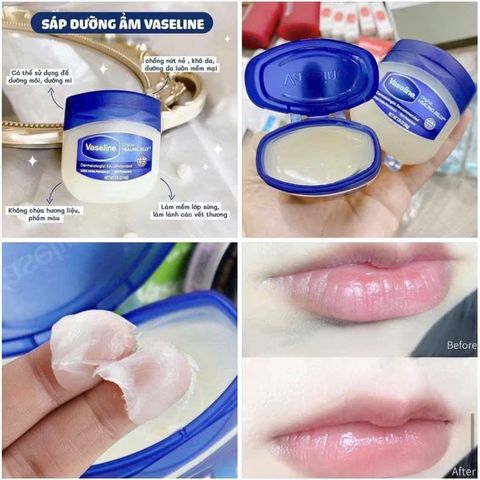 Sáp Dưỡng Ẩm Vaseline Original Protecting Jelly - Kem Chống Nẻ Đa Chức Năng 50ml & 100ml - Dưỡng Ẩm Môi & Da Đặc Biệt