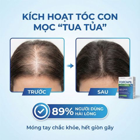 Viên Uống Mọc Tóc Arkopharma forcapil Anti-Chute 30 Viên - Hỗ Trợ Tóc Mọc Dày Khỏe, Ngăn Ngừa Rụng Tóc, Cải Thiện Tình Trạng Tóc Mỏng