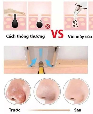 Máy Hút Mụn Đầu Đen Sạc USB - Làm Sạch Da, Loại Bỏ Chất Bẩn, Tăng Độ Đàn Hồi Cho Làn Da, Dễ Dàng Sử Dụng