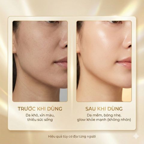 Dầu Khô Đa Năng Nuxe Huile Prodigieuse 100ml - Dưỡng Da và Tóc, Giải Pháp Chăm Sóc Da Mùa Đông, ngừa Lão Hóa, Mềm Mịn tự nhiên