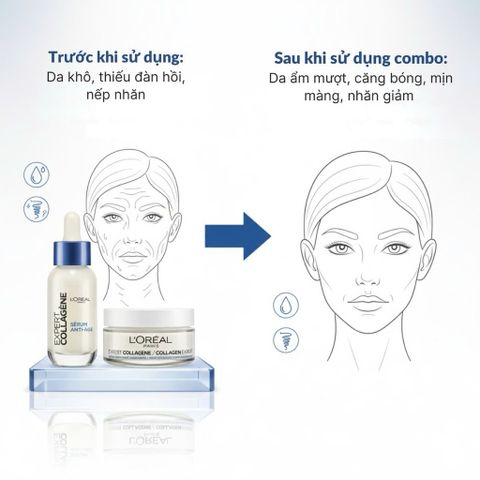 Kem Dưỡng Da L’Oréal Collagen Expert 50ml - Dưỡng Ẩm, Cải Thiện Độ Đàn Hồi và Săn Chắc Da Trưởng Thành