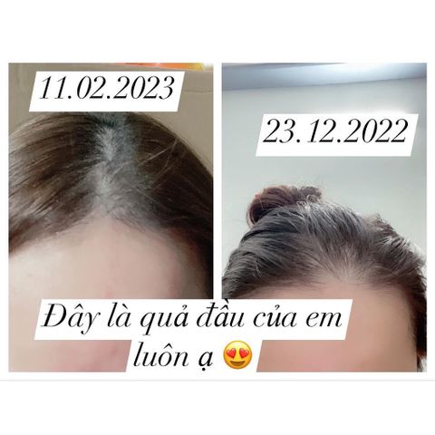 Xịt mọc tóc Minoxidil 5% BAILLEUL - Giảm rụng tóc, kích thích mọc tóc hiệu quả cho nam và nữ - Best Seller Pháp