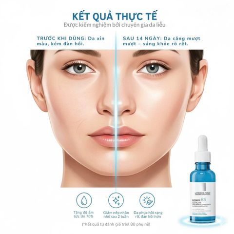 Tinh Chất La Roche-Posay Hyalu B5 50ml - Serum Dưỡng Ẩm, Phục Hồi, Ngừa Lão Hóa, Tái Tạo Da Mặt Rạng Rỡ, Săn Chắc(date 8/27)