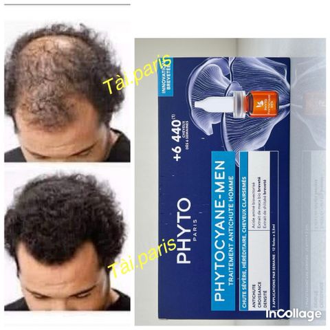 Serum Mọc Tóc Nam Phyto Phytocyane - Ngăn Rụng Tóc, Kích Thích Tăng Mật Độ Tóc, Hộp 12 Ống 7.5ml, Dưỡng Tóc Chắc Khỏe