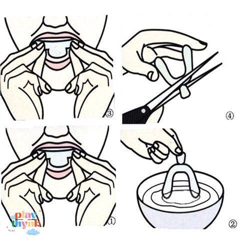 Silicone Bảo Vệ Răng Khi Ngủ - 2 Miếng Đệm Nhẹ Nhàng, Tốt Cho Sức Khỏe Răng Miệng, Giúp Ngủ Ngon Giấc