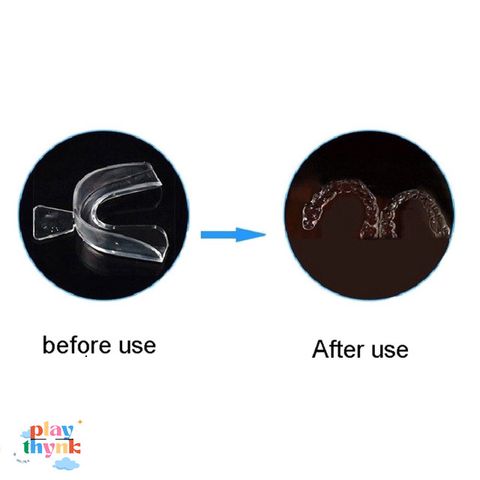 Khay Làm Trắng Răng Silicone Cực Mềm 4 Miếng - Bảo Vệ Răng Khi Ngủ, Phòng Ngừa Mài Răng, Chăm Sóc Răng Miệng Tại Nhà