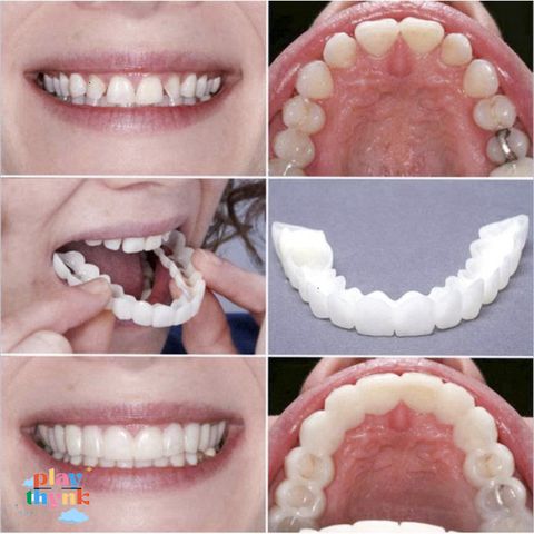 Răng Giả Silicon Tự Nhiên - Set 2 Hàm Răng Giả Mềm Mại, Đeo Thoải Mái, Giải Pháp Thẩm Mỹ Cho Nụ Cười Hoàn Hảo