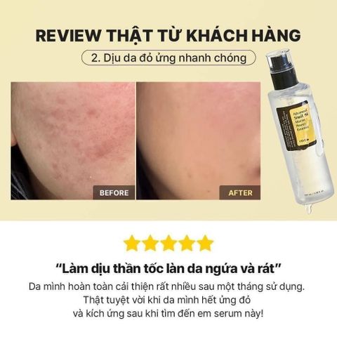 Tinh Chất Dưỡng Ẩm Cosrx Advanced Snail 96 Mucin Power Essence 100ml - Serum Phục Hồi Da, Cấp Nước, Chống Lão Hóa Chính Hãng