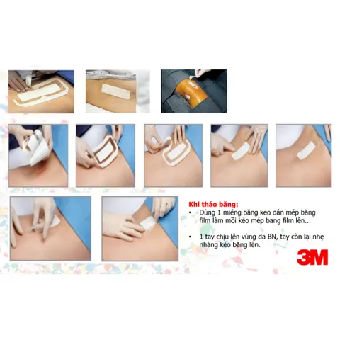 Băng phim dính y tế trong suốt có gạc vô trùng 3M™ Tegaderm™+pad 3586, size 9 x 10cm | Xuất xứ Mỹ