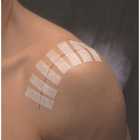 Hộp 50 gói băng y tế thay chỉ khẩu da 3M Steri-strip™ R1546 - Cho vết thương tiểu phẫu - Túi 10 miếng