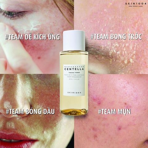 Nước Hoa Hồng Skin1004 Madagascar Centella Toning 210ml - Toner Cao Cấp Hỗ Trợ Phục Hồi Da Nhạy Cảm, Chống Viêm, Làm Sạch Sâu