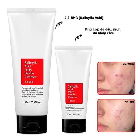 Sữa Rửa Mặt Giảm Mụn Cosrx Salicylic Acid Gentle Cleanser 150ml - Dành Cho Da Mụn, Làm Sạch Hiệu Quả, Dịu Nhẹ Xách Tay Chính Hãng