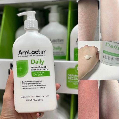 Sữa Dưỡng Thể Dưỡng Ẩm AmLactin 567g - Giúp Da Mềm Mịn, Sáng Đều Màu, Chống Khô Nứt, Phù Hợp Với Mọi Loại Da