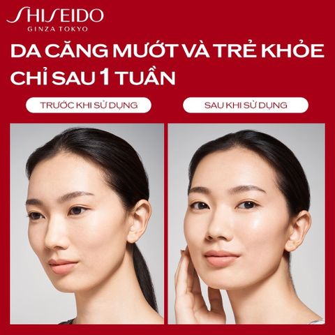 Nước thần đỏ Shiseido Eudermine Activating Essence - Chăm sóc da, cấp ẩm, làm sáng da, phù hợp mọi loại da, hàng chính hãng từ Nhật Bản