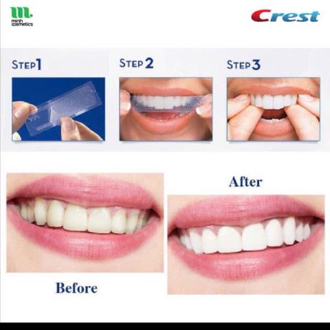 Bộ Dán Trắng Răng Crest 3DWhitestrips - Làm Trắng Đến 18 Cấp Độ, Công Nghệ Bám Chắc, 14 Gói Tại Nhà, Nụ Cười Rạng Rỡ