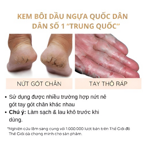 Kem Dưỡng Ẩm Dầu Ngựa 30g - Giảm Nứt Giày Cao Gót & Dưỡng Da Mềm Mại - Sản Phẩm Chăm Sóc Da Chân Chất Lượng Cao