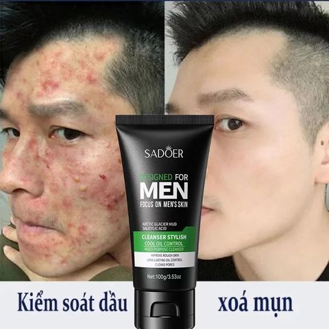 Sữa Rửa Mặt Dành Cho Nam Ngừa Mụn Than Hoạt Tính 100g - Làm Sạch Sâu, Giảm Nhờn, Tươi Mát, Dành Cho Da Đàn Ông