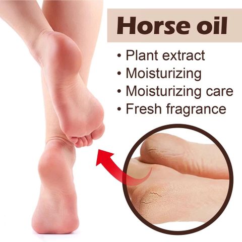 Kem Bôi Ngựa Nứt Gót Chân Nẻ Tay - Kem Chăm Sóc Da Chân Hiệu Quả, Dưỡng Ẩm và Phục Hồi Da Khô, 300g