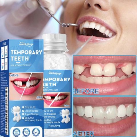 Bộ Dụng Cụ Trám Răng Tức Thời 30ML - Keo Dán Định Hình Răng Giả, Giải Pháp Chăm Sóc Răng Miệng Nhanh Chóng, Tiện Lợi Tại Nhà
