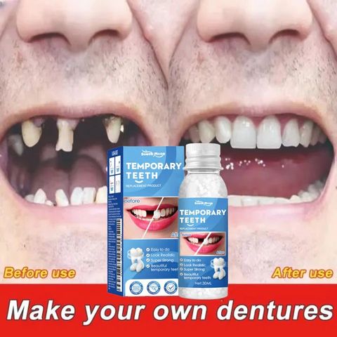Bộ Dụng Cụ Trám Răng Tức Thời 30ML - Keo Dán Định Hình Răng Giả, Giải Pháp Chăm Sóc Răng Miệng Nhanh Chóng, Tiện Lợi Tại Nhà