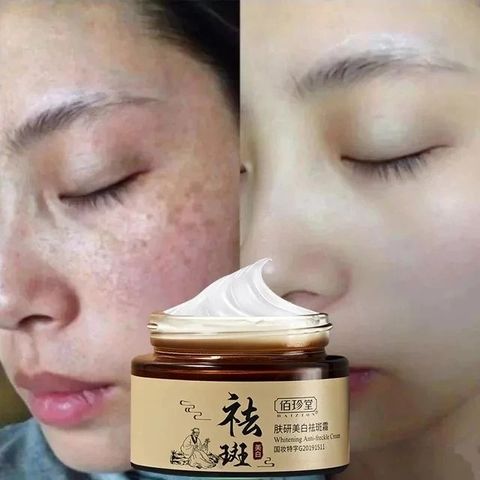 Kem Nám Tàn Nhang Trắng Da Mặt 30g - Giải Pháp Làm Sáng Da và Dưỡng Ẩm Hiệu Quả, Loại Bỏ Đốm Nám và Tàn Nhang