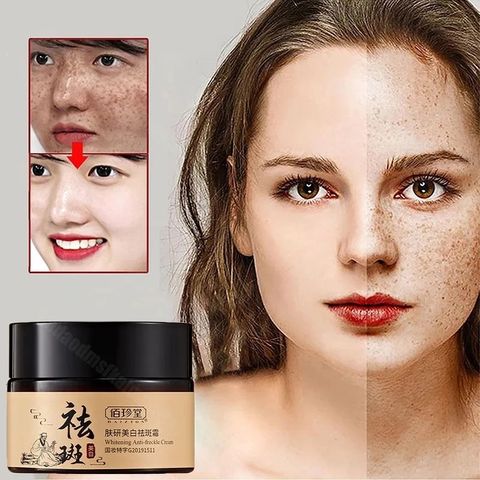 Kem Nám Tàn Nhang Trắng Da Mặt 30g - Giải Pháp Làm Sáng Da và Dưỡng Ẩm Hiệu Quả, Loại Bỏ Đốm Nám và Tàn Nhang