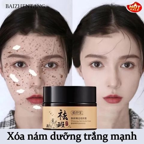 Kem Nám Tàn Nhang Trắng Da Mặt 30g - Giải Pháp Làm Sáng Da và Dưỡng Ẩm Hiệu Quả, Loại Bỏ Đốm Nám và Tàn Nhang