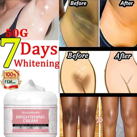 Kem Làm Trắng Da West&Month 50g - Mờ Thâm Nách, Bẹn, Mông, Khuỷu Tay, Đầu Gối - Dưỡng Ẩm và Làm Sáng Da Hiệu Quả