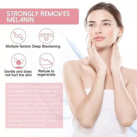 Kem Làm Trắng Da West&Month 50g - Mờ Thâm Nách, Bẹn, Mông, Khuỷu Tay, Đầu Gối - Dưỡng Ẩm và Làm Sáng Da Hiệu Quả