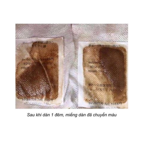 Miếng Dán Thải Độc Chân Kenko Nhật Bản - Hộp 30 Miếng Giúp Thải Độc, Thư Giãn, Cải Thiện Tuần Hoàn Máu