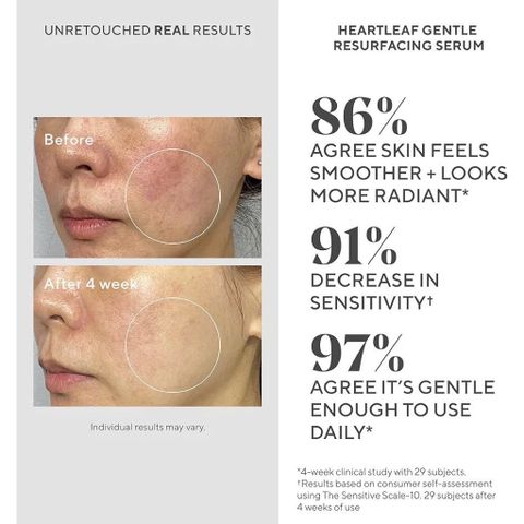 Serum Dưỡng Ẩm M.u.r.a.d Heartleaf Gentle Resurfacing - Phục Hồi Da Nhạy Cảm, Làm Sáng, Mịn Da, Chống Lão Hóa