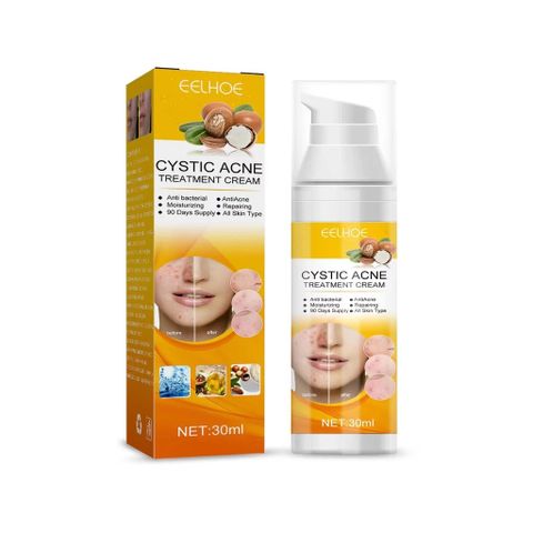 Gel Trị Mụn Nhanh - Hỗ Trợ Giảm Mụn Trong 3 Ngày, Kiểm Soát Dầu, Làm Mờ Vết Thâm Da - Sản Phẩm Cho Da Dầu, Da Dễ Nổi Mụn