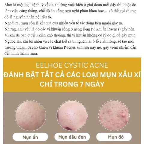 Gel Trị Mụn Nhanh - Hỗ Trợ Giảm Mụn Trong 3 Ngày, Kiểm Soát Dầu, Làm Mờ Vết Thâm Da - Sản Phẩm Cho Da Dầu, Da Dễ Nổi Mụn