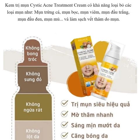 Gel Trị Mụn Nhanh - Hỗ Trợ Giảm Mụn Trong 3 Ngày, Kiểm Soát Dầu, Làm Mờ Vết Thâm Da - Sản Phẩm Cho Da Dầu, Da Dễ Nổi Mụn