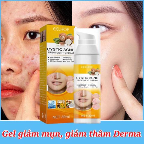 Gel Trị Mụn Nhanh - Hỗ Trợ Giảm Mụn Trong 3 Ngày, Kiểm Soát Dầu, Làm Mờ Vết Thâm Da - Sản Phẩm Cho Da Dầu, Da Dễ Nổi Mụn