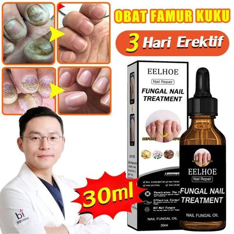 Serum Dưỡng Móng Eelhoe 30ml - Hỗ Trợ Loại Bỏ Nấm Móng, Cải Thiện Móng Hư Tổn, Dưỡng Chắc Khỏe Tự Nhiên