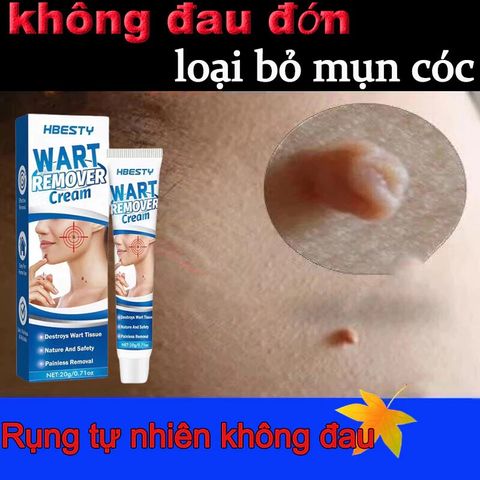 Kem Tẩy Nốt Ruồi & Lột Mụn Cóc 20g - Giải Pháp Hiệu Quả Cho Làn Da Mịn Màng, Dưỡng Ẩm Chuyên Sâu