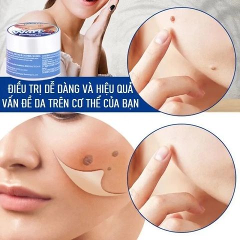 Kem Tẩy Nốt Ruồi & Lột Mụn Cóc 20g - Giải Pháp Hiệu Quả Cho Làn Da Mịn Màng, Dưỡng Ẩm Chuyên Sâu