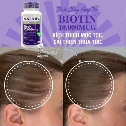 Viên Uống Natrol Biotin 10000 Mcg hộp 100 Viên Của Mỹ - Biotin 10.000 mcg 621493