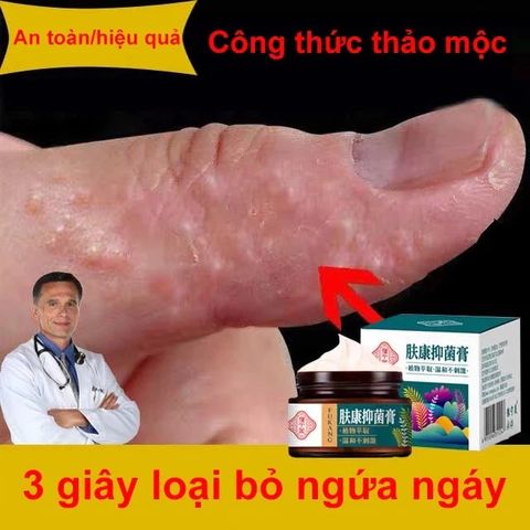 Kem chống ngứa kem kháng khuẩn chống dị ứng khỏi tận gốc viêm da bệnhh chàm Ngứa da nấm da nấm mụn nước tổ đỉa 30g