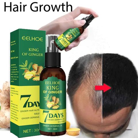 kích thích mọc tóc nhanh làm dày Chiết xuất hoàn toàn từ thiên nhiên không có tácc dụngg phụ giúp giảm rụng tóc